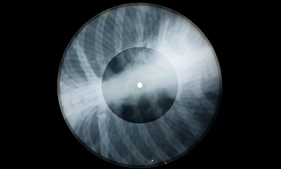 The x-ray pressing of Ella Fitzgerald’s Lullaby of Birdland.