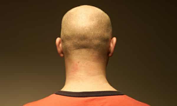 I Ve Been Bald For Years And I Still Miss My Hair Mark Powlett The Guardian I Ve Been Bald For Years And I Still Miss My Hair Mark Powlett The Guardian