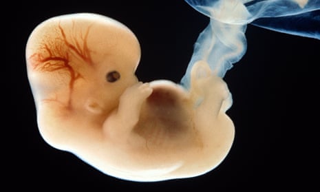 A six-week-old human embryo