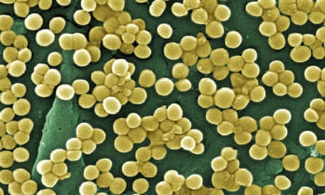 A scanning electron micrograph of MRSA (methicillin-resistant Staphylococcus aureus)