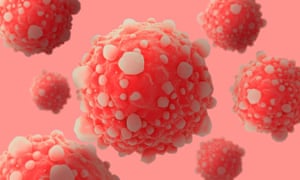 Μικροσκοπική άποψη των παγκρεατικών καρκινικών κυττάρων
