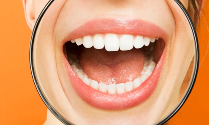 Health feature: Examining the growing body of evidence about mouth-body association, ie how dental issues can affect more than just our oral health and possibly cause cancer, diabetes and other serious illnesses (web and print)Young woman putting magnifying glass over mouth and laughing, portrait