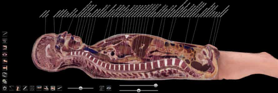 Internal organs and bones are visible in this virtual cross-section of a human body