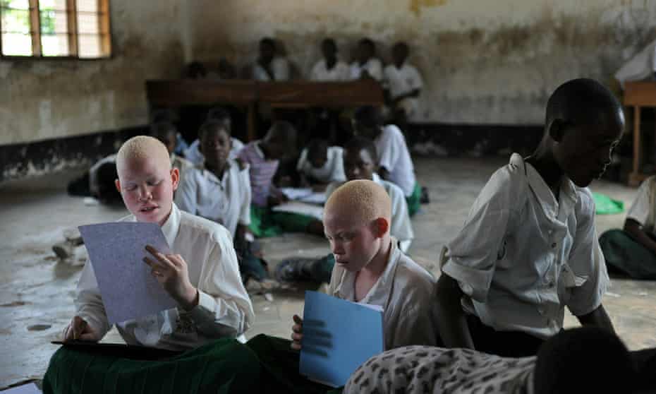 Albino children studying at the Mitindo primary school for the blind in Tanzania. At least 74 people with albinism have been murdered in the country since 2000.