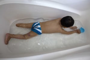 Injured Palestinian three year-old Sharif al-Namlah plays in the bath at his family's home in Rafa, Gaza