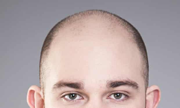 Bald hairstyle semi Coolest Practical