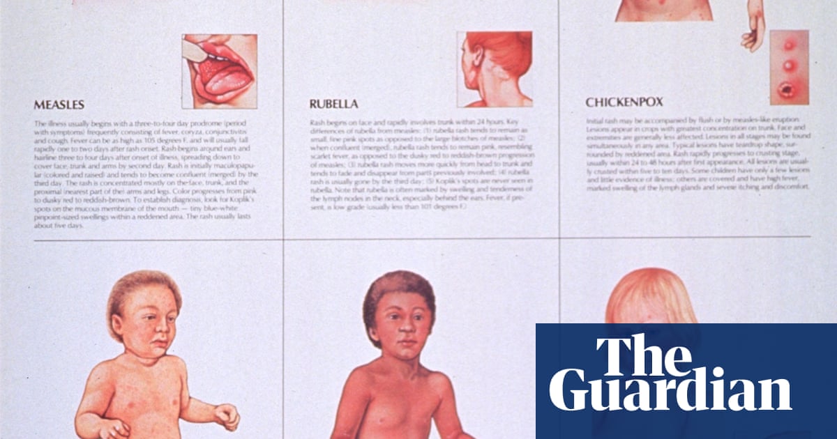 Measles Outbreak Australia 2025