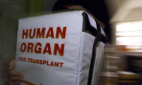A special cool box for transporting human organs.