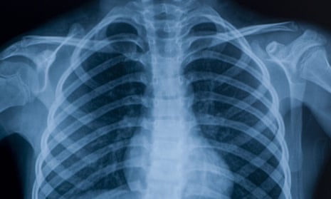 Operations and scans incliuding X-rays could be carried out by private companies