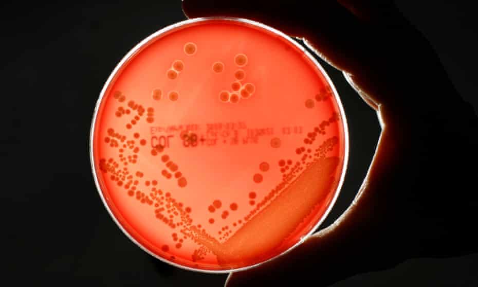 MRSA (Methicillin-resistant Staphylococcus aureus) bacteria strain is seen in a petri dish containing agar jelly for bacterial culture in a microbiological laboratory in Berlin March 1, 2008. 