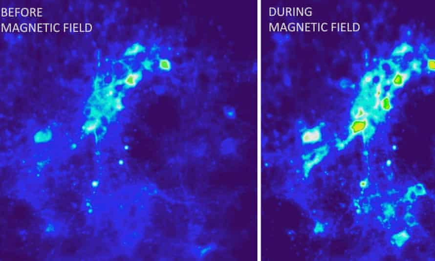 Heat dissipates from iron oxide nanoparticles in an alternating magnetic field, triggering nervous impulses by activation of TRPV1 channels.