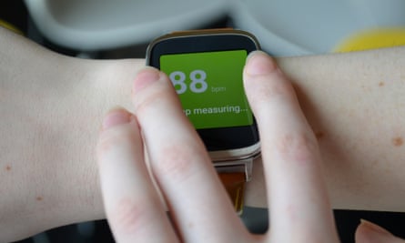 Asus zenwatch 1 band size on sale