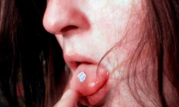 Psychedelic drugs like LSD could be used to treat depression ...