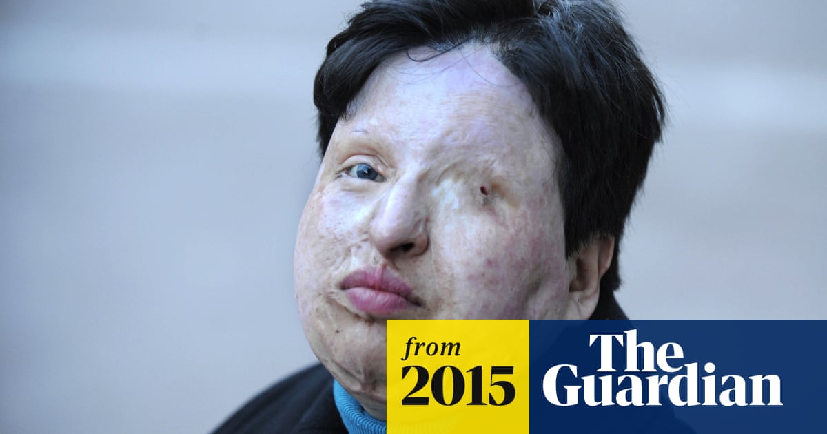 Eye for an eye: Iran blinds acid attacker