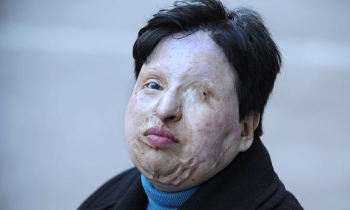 Eye For An Eye Iran Blinds Acid Attacker Iran The Guardian