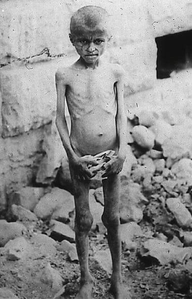 An Armenian boy suffering from starvation in 1915.