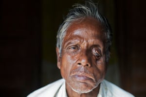 Local fisherman Rabi Majumdar, 63, was attacked by a tiger. ‘As the tiger jumped, he caught hold of my head and pulled me backwards. The whole world became dark. I could no longer see anything as my head was inside the tiger’s mouth. I still don’t have vision in one eye,’ he says.