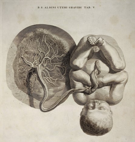 Fetus with umbilical cord and placenta. Wellcome Library, London. 