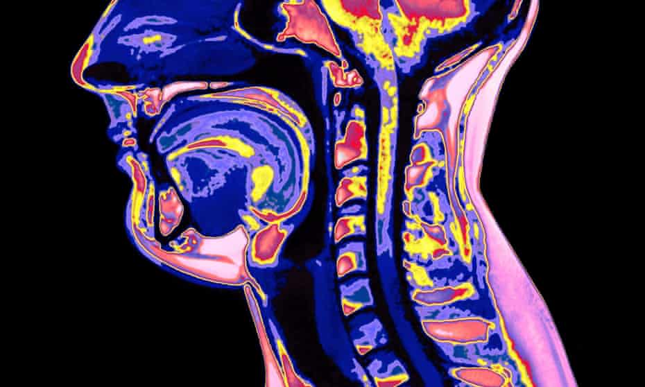 An MRI scan of the vocal tract, with the glottis, or vocal cords in dark blue to the right of the neck vertebrae. 