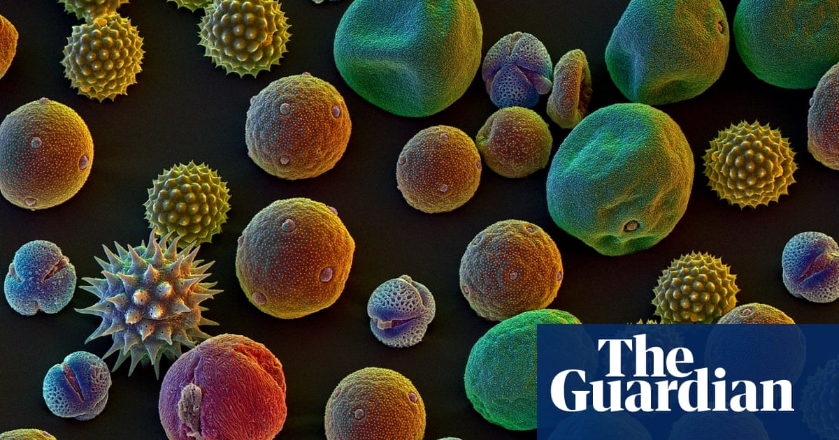 Have I Got Hay Fever Or Another Kind Of Allergy Life And Style The Guardian