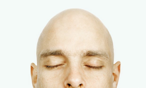 Bald truth: plucking hair out can stimulate growth, study finds | Science |  The Guardian