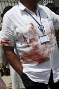 A hospital official in a blood stained shirt stands outside a hospital in Karach.