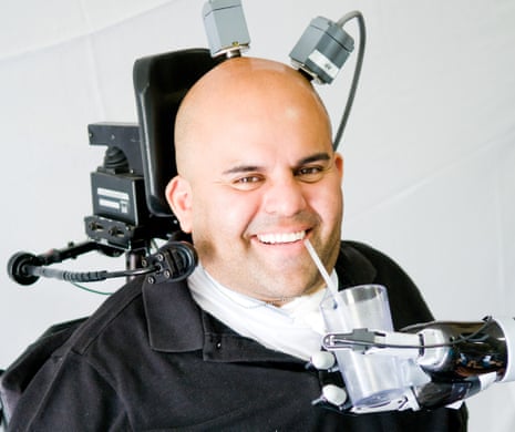 A neuro-prosthetic device implanted in Erik Sorto’s brain allowed him to drink unaided for the first time in ten years.