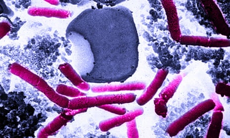 The Pentagon says it accidentally sent live anthrax spores to laboratories.