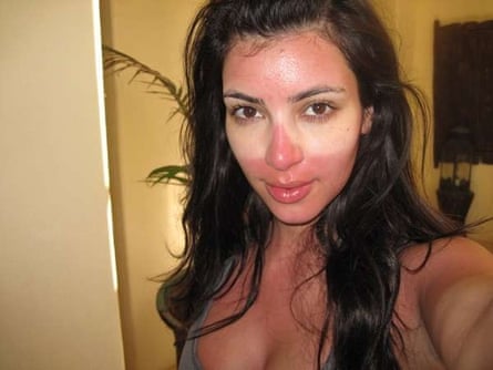 What Kardashian looks like with sunburn.