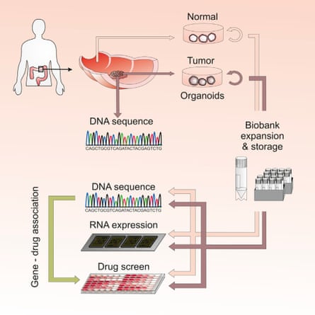 A flow chart showing how the organoid cultures are created from a combination of healthy and cancerous patient tissue and used for drug screening.