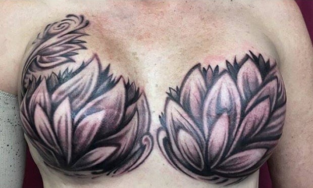 The tattoos that turn breast cancer surgery scars into works of art | Breast  cancer | The Guardian