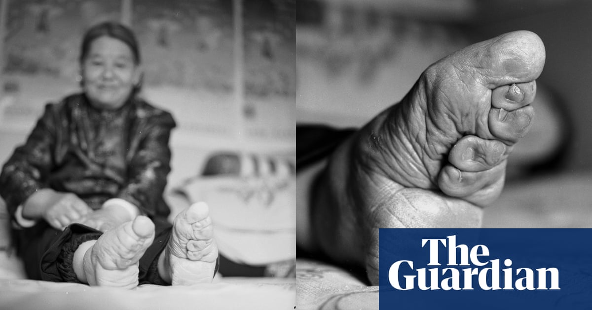 Unbound China S Last Lotus Feet In Pictures Art And Design The Guardian