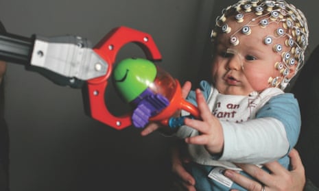 Eight-month-old baby Thomas Crabtree having his brain monitored while playing.