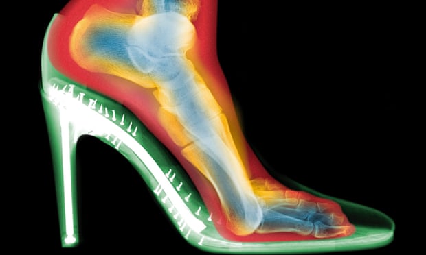 What damage are high heels doing to your feet?