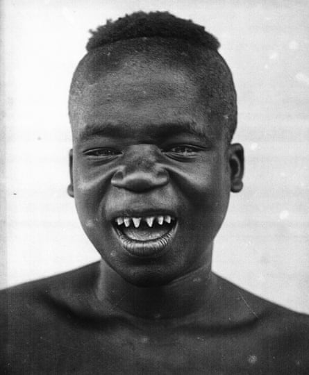 A portrait of Ota Benga taken in Congo. His sharp teeth were the result of tooth chipping, a practice that was popular among young men.