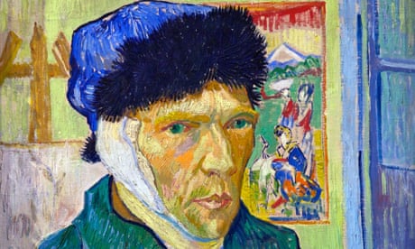 It Was All Yellow Did Digitalis Affect The Way Van Gogh Saw The