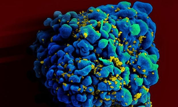 Experts say that merely sustaining the major efforts already in place will not be enough to stop deaths from Aids increasing within five years in many countries … an electron microscope image of the human immunodeficiency virus (HIV), yellow.