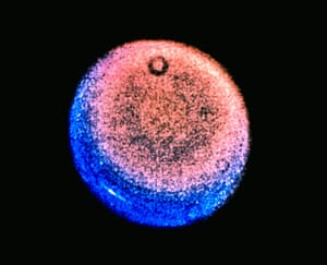 This picture of Uranus is a highly processed composite of three images obtained in 1986