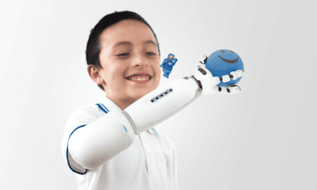 Lego is just the beginning … Torres imagines prosthetic partnerships with Mattel and Nintendo.