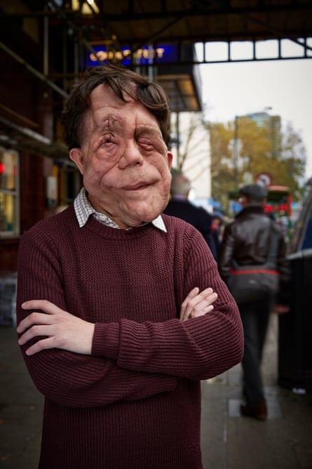 Adam Pearson, writer and presenter of The Ugly Face of Disability Hate Crime: 'funny, and making a difference'.