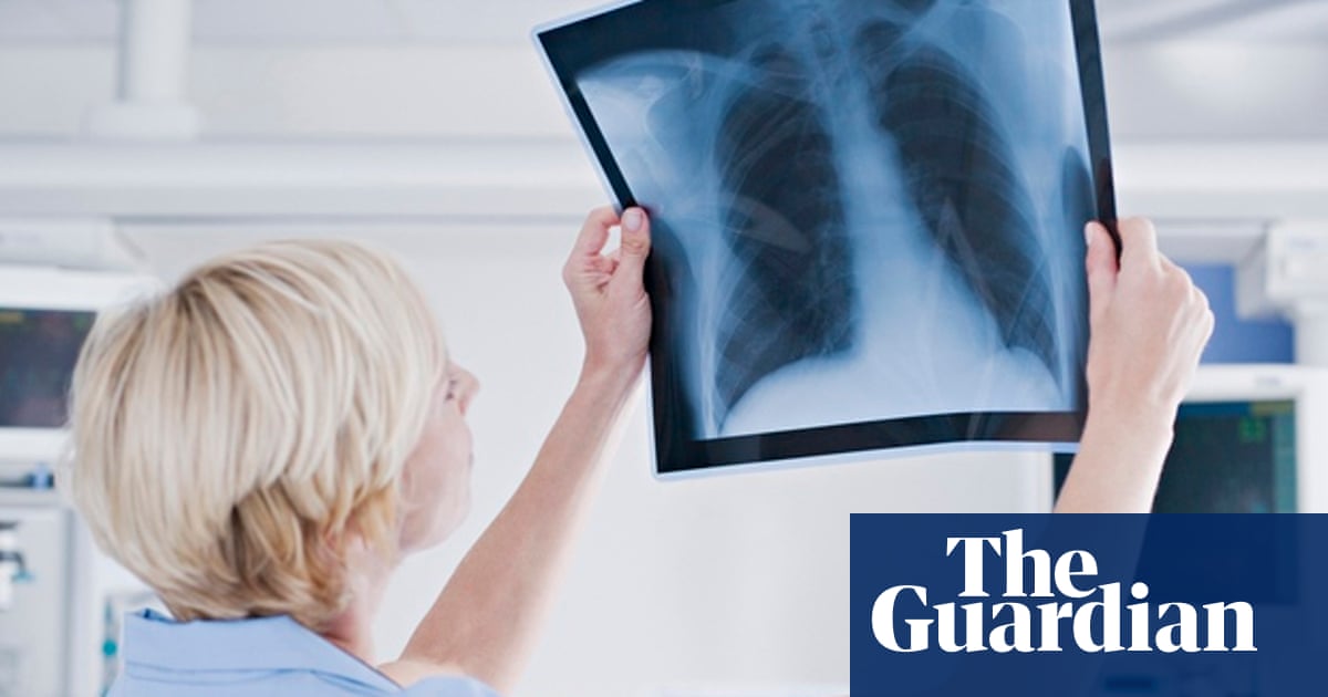 Radiography Students In Hospitals Tell Stories That Make Me Want To Weep Healthcare Network The Guardian
