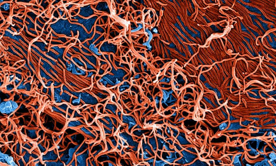An image provided by the National Institute of Allergy and Infectious Diseases shows a a scanning electron micrograph of Ebola virus particles (red).