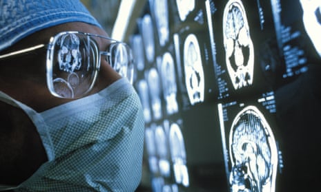 Surgeon examing MRI scans of a brain