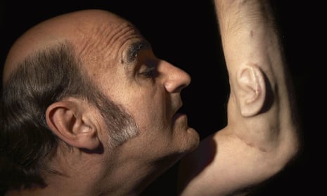 Third ear … Australian performance artist Stelarc has been growing a human ear on his arm for the last nine years.