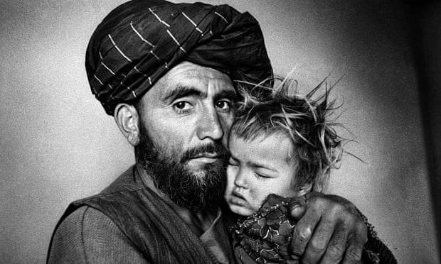 Afghan girl with malaria