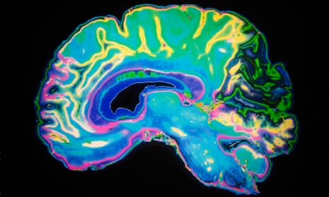 Artificially Coloured MRI Scan Of Human Brain. 