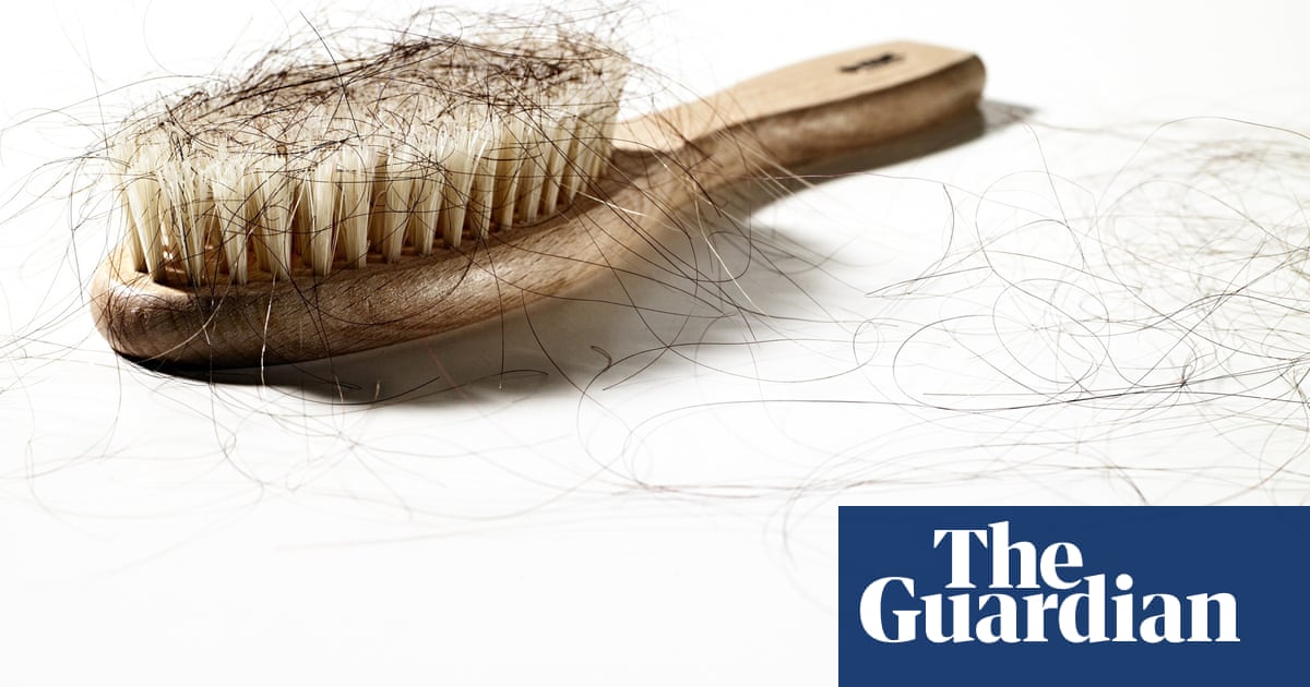 Should I worry about my hair loss? | Health & wellbeing | The Guardian