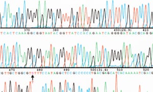 Part of a DNA base sequence read generated by an automated sequencer.