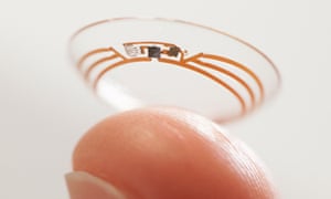 contact lens