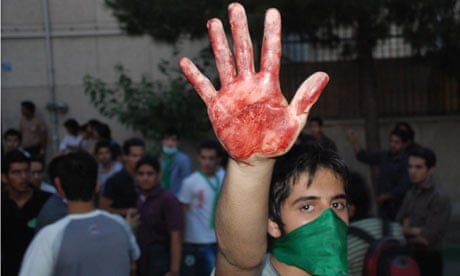 Iran protestor's bloodied hand